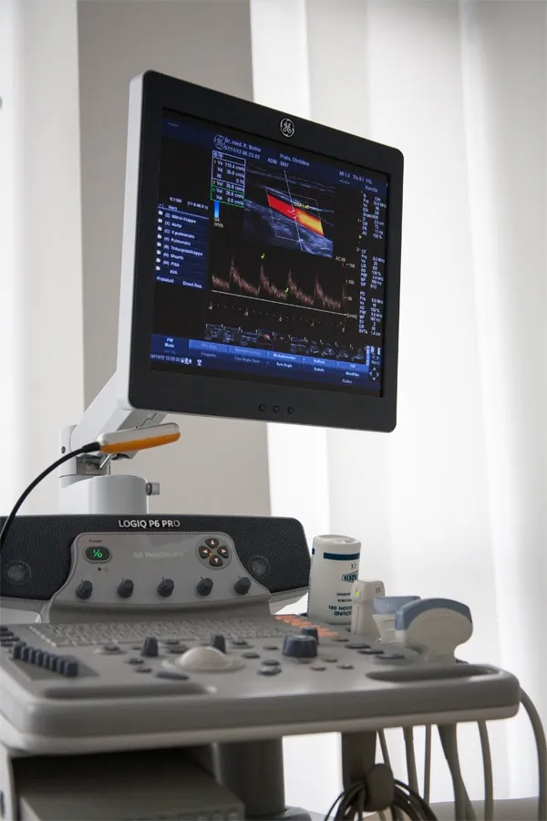 Ultraschallgerät in der Praxis mit farbiger Doppler-Darstellung auf dem Bildschirm